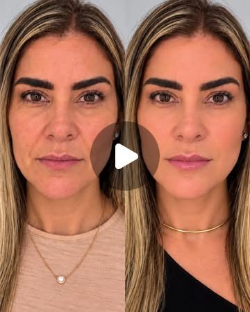 Antes e depois facial